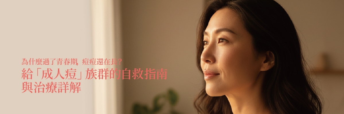 為什麼過了青春期,痘痘還在長?給「成人痘」族群的自救指南與治療詳解